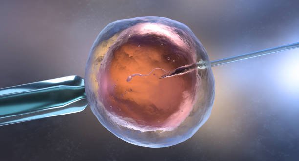 IVF Procedure