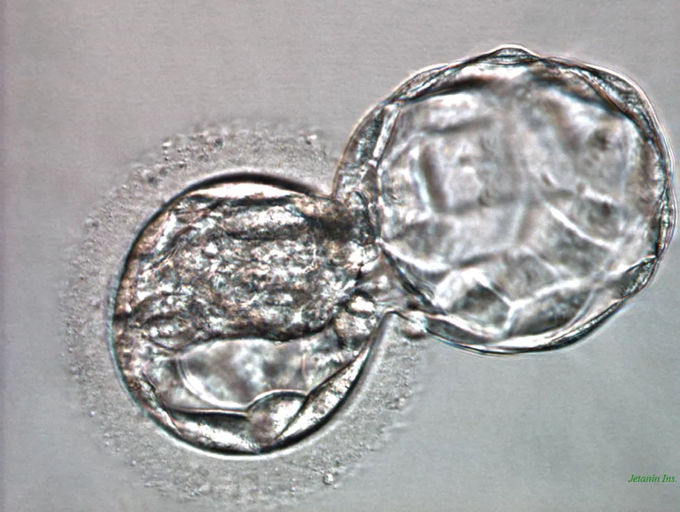 Embryo Transfer