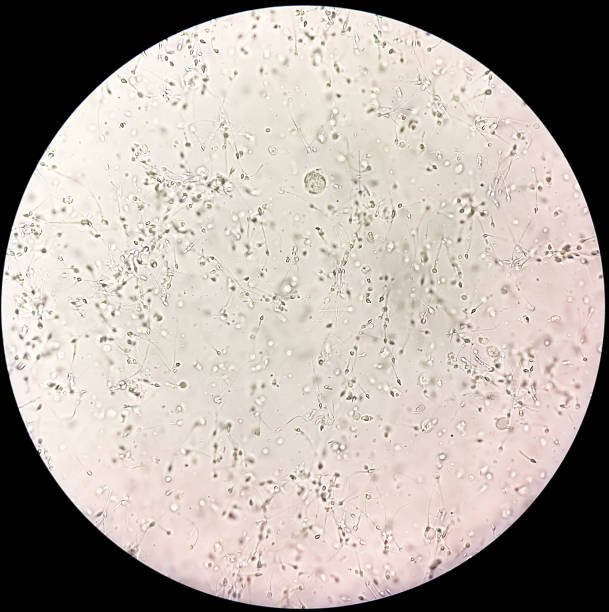 Advanced Semen Analysis